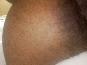 ASSNDDICK1