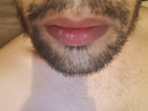 Autosuce