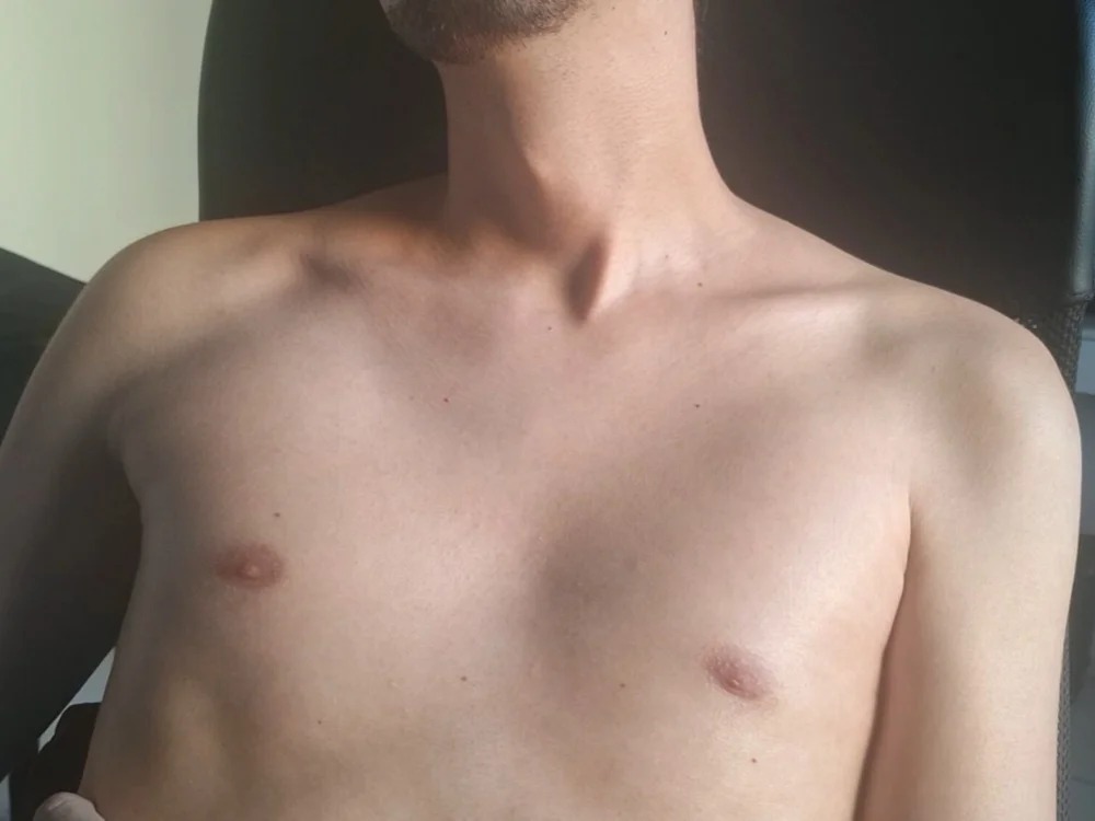 BiNovinho22cm Chatroom