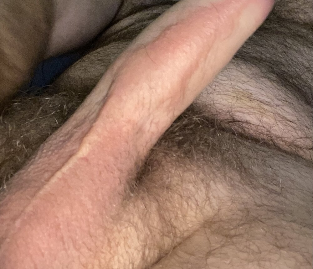 Hairy7incher Chatroom