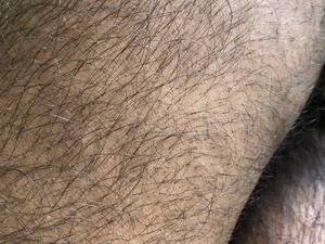 Hairy_dick6