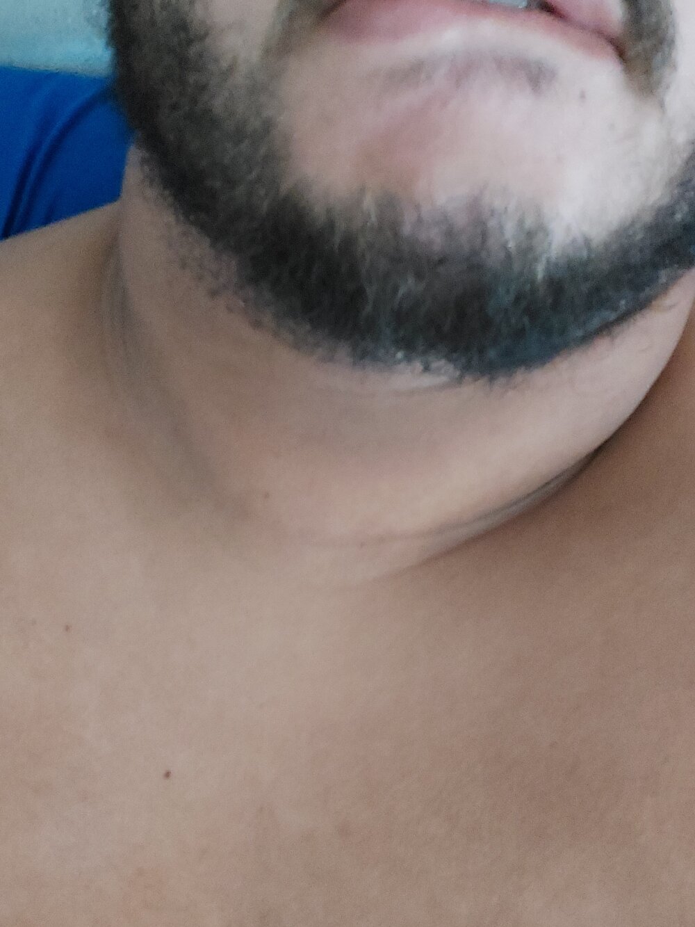 UrsoPeitudo01 Chatroom