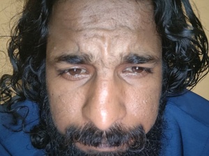 akkubab