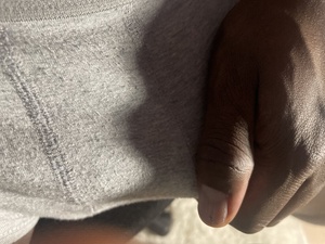 blackbite0